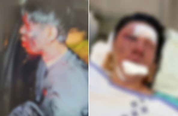 韓国ユーチューバーを拉致し野球バットで頭部殴打、懲役30年判決にも「無期ではないのか」と怒りの声